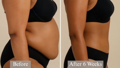 Before and after 6-week progress photo showing natural waistline slimming and visible toning from consistent waist training and Bodied by Bella supplement routine.